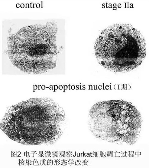 细胞凋亡形态学检测方法